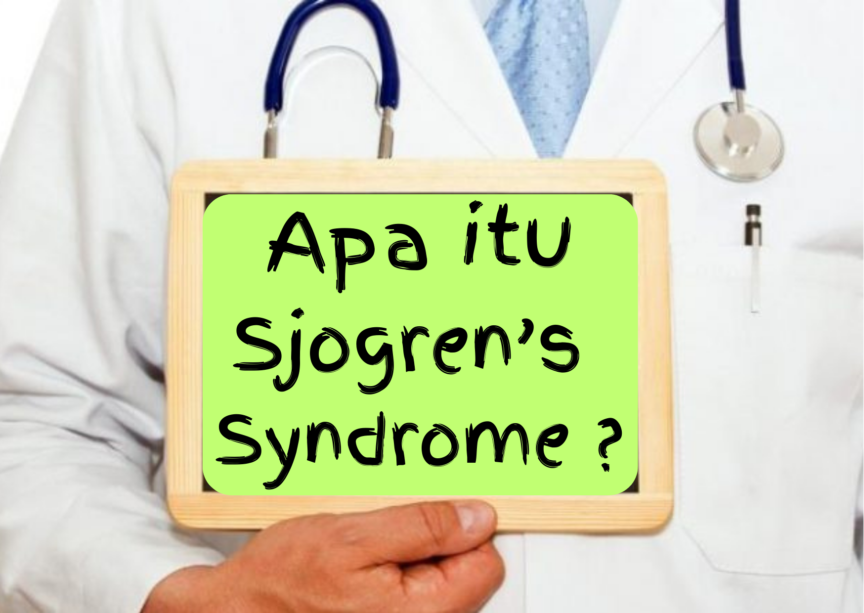 Apa itu Sjogren's Syndrome ?